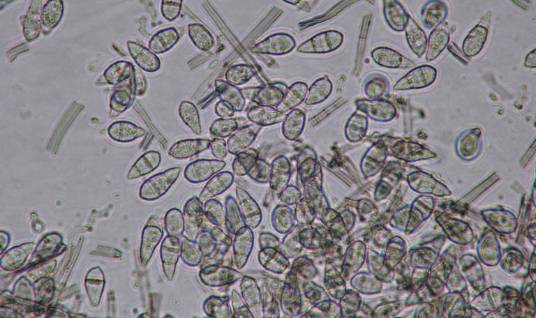 spores caractéristiques de Gray Leaf Spot observés au microscope